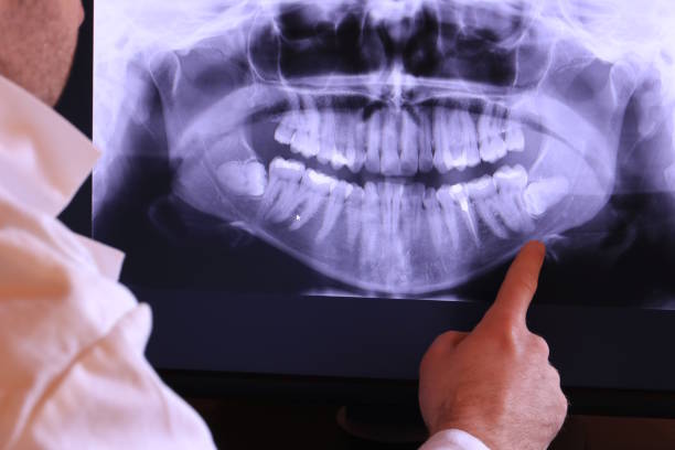 Best Emergency Broken Tooth Repair in Hartland, WI